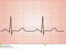 /arquivos/pessoas/130722041119grAfico-normal-da-pulsaCAo-do-coraCAo-ecg-71108214_133_100.jpg