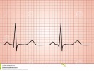 /arquivos/pessoas/131102041119grAfico-normal-da-pulsaCAo-do-coraCAo-ecg-71108214_133_100.jpg